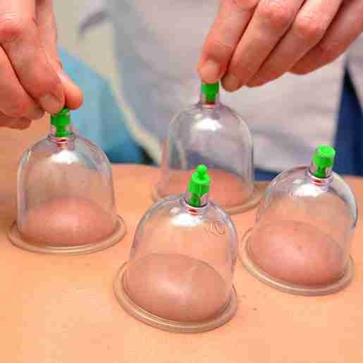 Medical acupuncture treatment for pain relief