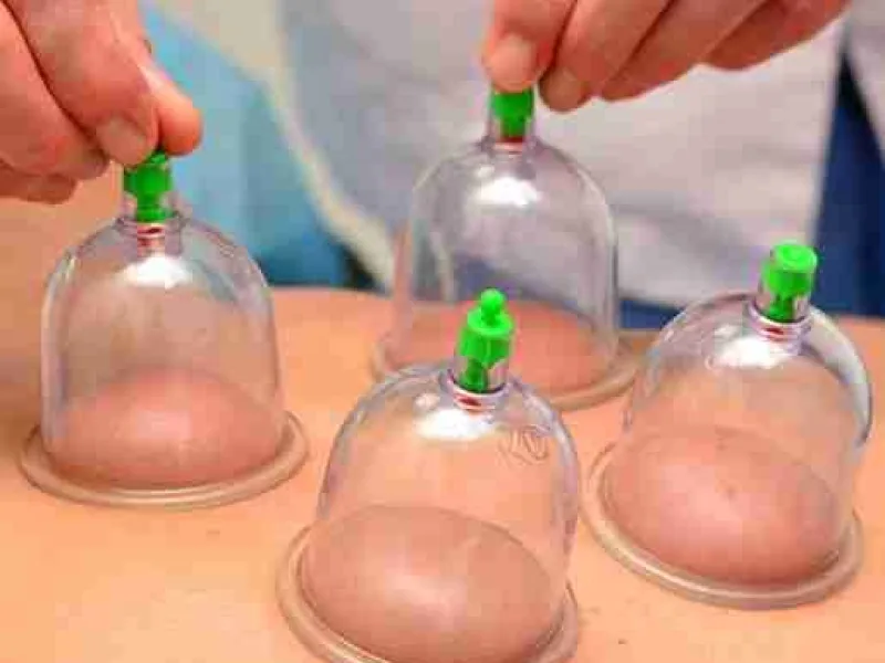 Acupuncture at AyurSoul Healthcare